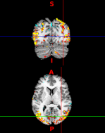 arxiv.org pdf 1511.01609.pdf
